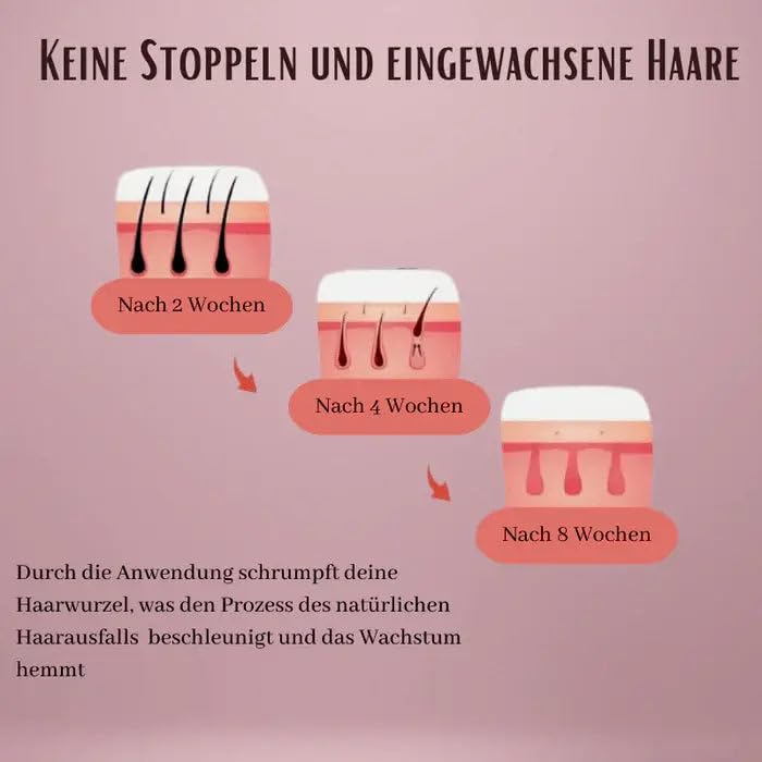 luxderm Glowora Silk3 IPL Epilierer Laser Dauerhafte Haarentfernung Laser Epilierer 5 Energiestufen 2 Modi IPL Epilierer Frauen Achseln Beine Körper