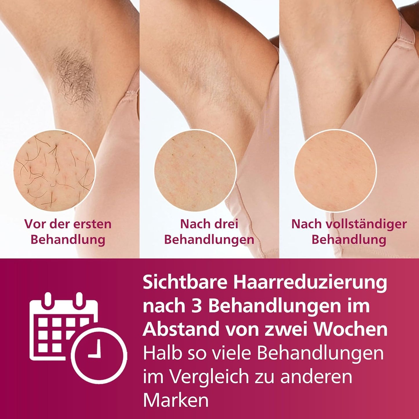 Philips Lumea IPL 7000 Series Haarentfernungsgerät – Alternative zur Laserhaarentfernung – 2 Aufsätze für Körper & Gesicht, inkl. Korrekturtrimmer (BRI921/00)