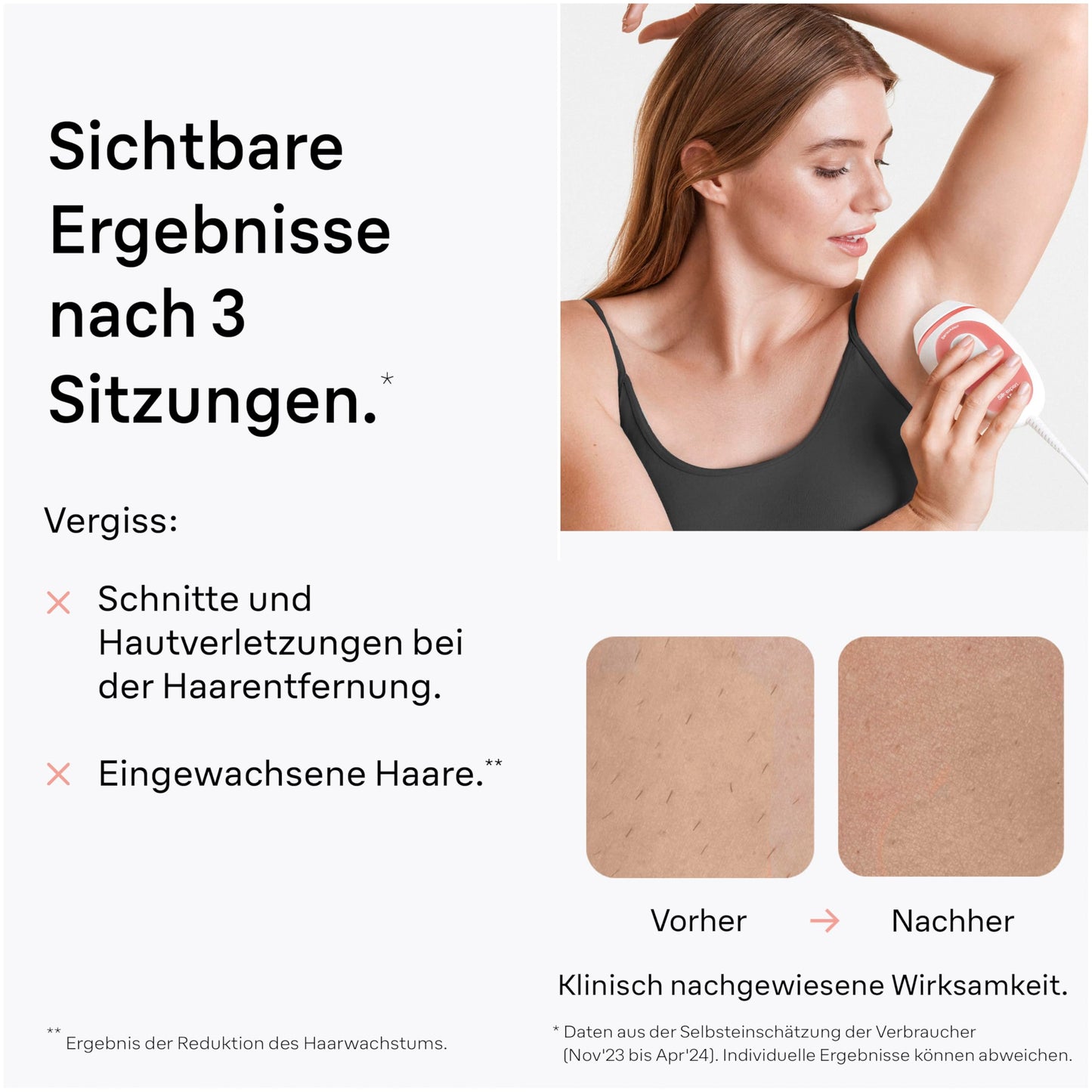 Braun IPL Silk-expert Mini – IPL Haarentfernungsgerät für Frauen, Dauerhafte und Schmerzfreie Haarentfernung – Kompakte Größe für unterwegs – Einfach, sicher und effizient – PL1000, Weiß/Rosa
